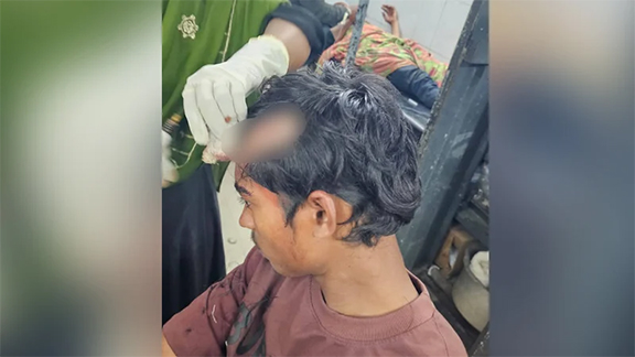 বাগেরহাটে বিএনপি-জামায়াত সংঘর্ষ, আহত ১৯